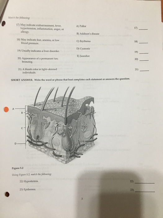 Solved Mitch the following: A) Pallor 17) May indicate | Chegg.com