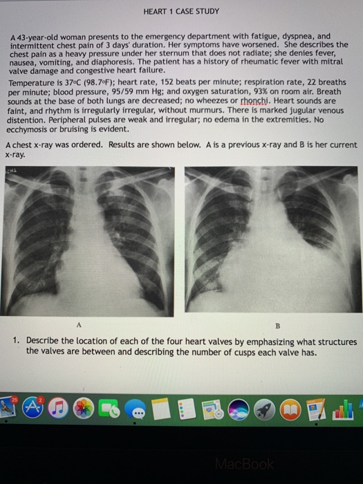 Solved HEART 1 CASE STUDY A 43-year-old woman presents to | Chegg.com