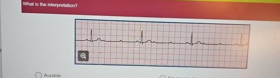 Solved What is the interpretation?Asystole | Chegg.com