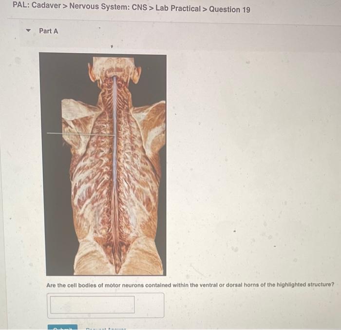 PAL: Cadaver > Nervous System: CNS> Lab Practical > Question 19
Part A
Are the cell bodies of motor neurons contained within 