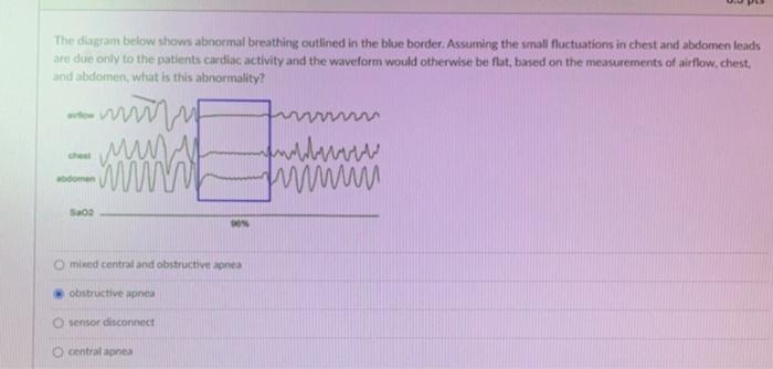 The diagram below shows abnormal breathing outlined in the blue border. Assuming the small fluctuations in chest and abdomen