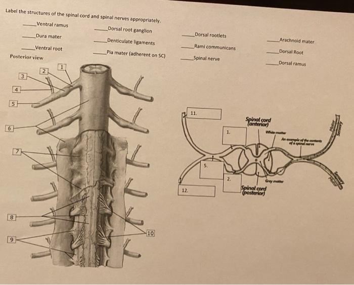 Solved Label the structures of the spinal cord and spinal | Chegg.com