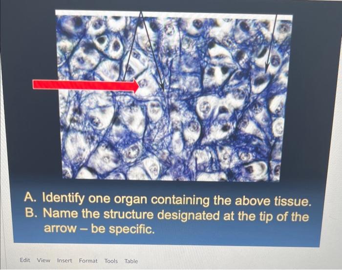 A. Identify one organ containing the above tissue. B. | Chegg.com