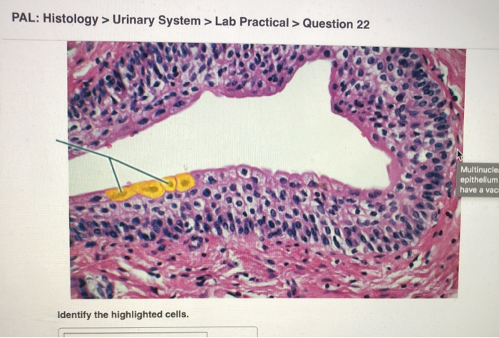 Solved PAL: Histology > Urinary System > Lab Practical > | Chegg.com