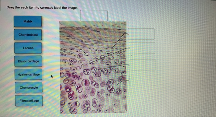 Solved Drag the each item to correctly label the image. | Chegg.com