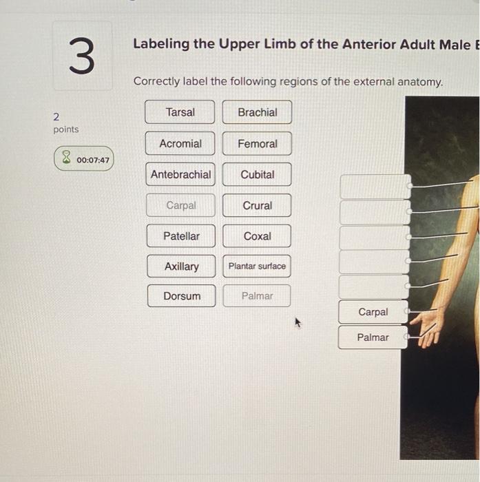 Solved Labeling the Upper Limb of the Anterior Adult Male E | Chegg.com
