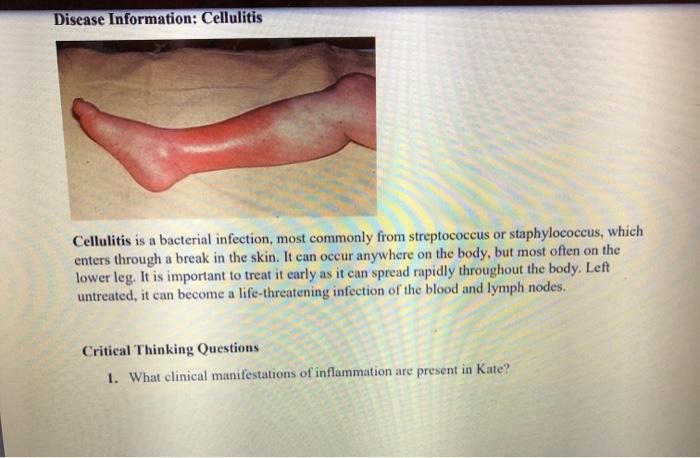 Disease Information: Cellulitis Cellulitis is a bacterial infection, most commonly from streptococcus or staphylococcus, whic