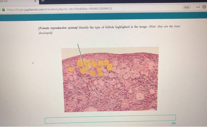 Solved [Female Reproductive System, Identify The Structure | Chegg.com