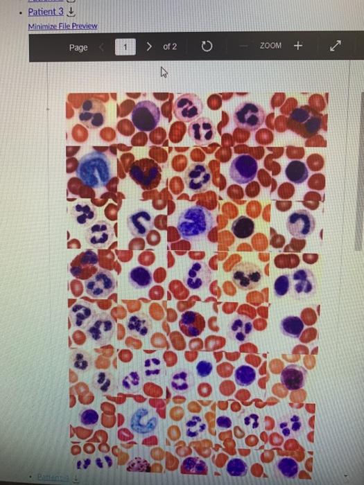 Solved Page 1 of 5 0 ZOOM + Case Study (Blood) Blood is | Chegg.com