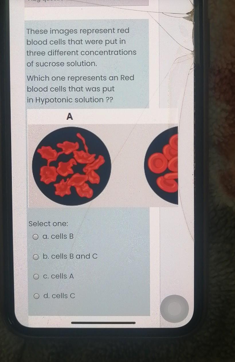 Solved These images represent red blood cells that were put | Chegg.com