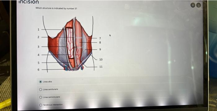 Solved Lower-Midline Abdominal Wall Incision (1) (2) 3 (4) | Chegg.com