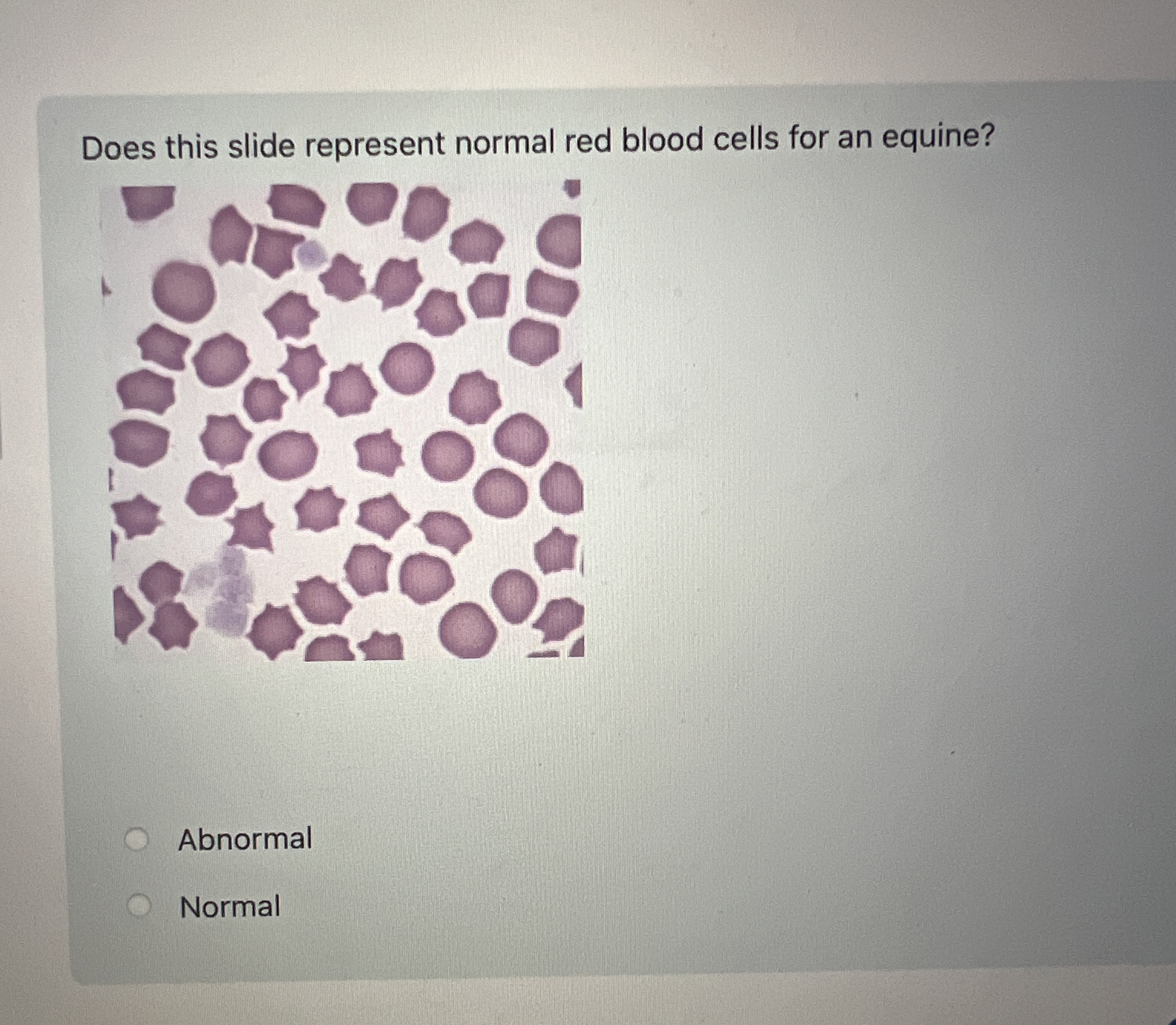 Solved Does this slide represent normal red blood cells for | Chegg.com