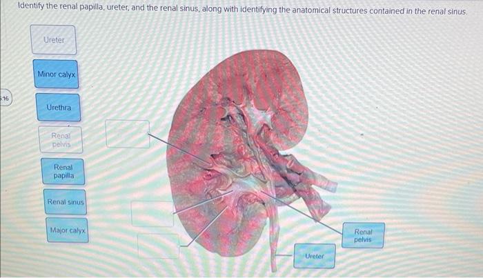 Identify the renal papilla, ureter, and the renal sinus, along with identifying the anatomical structures contained in the re