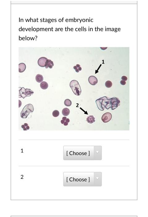 Solved In what stages of embryonic development are the cells Biology Diagrams