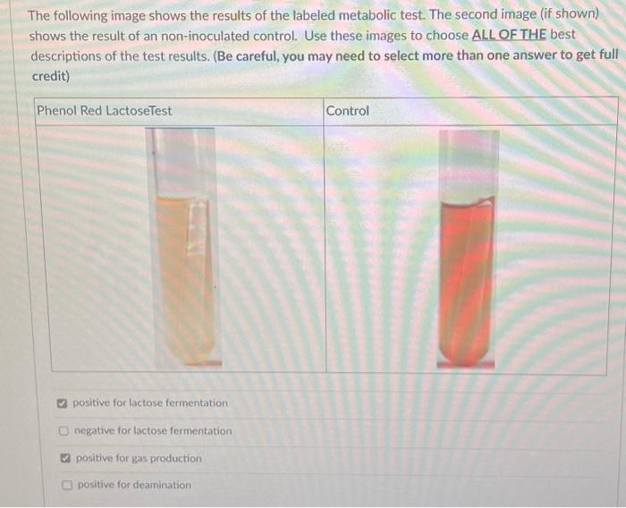 The following image shows the results of the labeled metabolic test. The second image (if shown) shows the result of an non-i