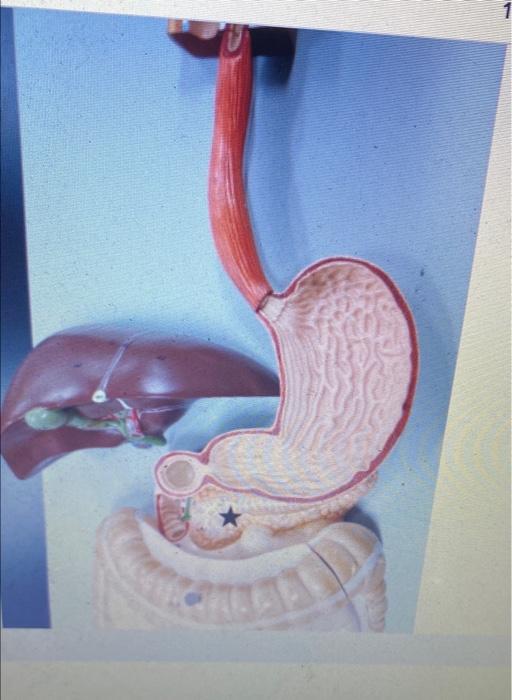 Solved Question 1 Brush border enzymes digest 1 Point carbs