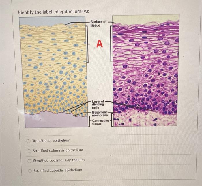 Solved Transitional epithelium Stratified columnar | Chegg.com