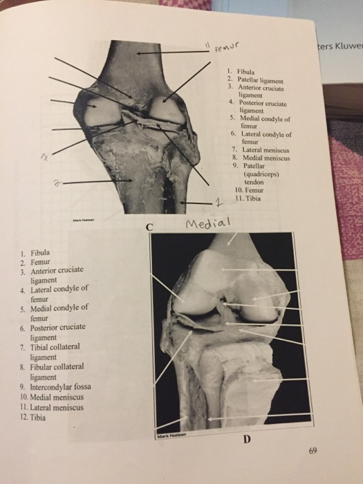 Solved AHAS 1. Atlas 2. Axis 3. Dens 4. Cervical vertebra 5. | Chegg.com