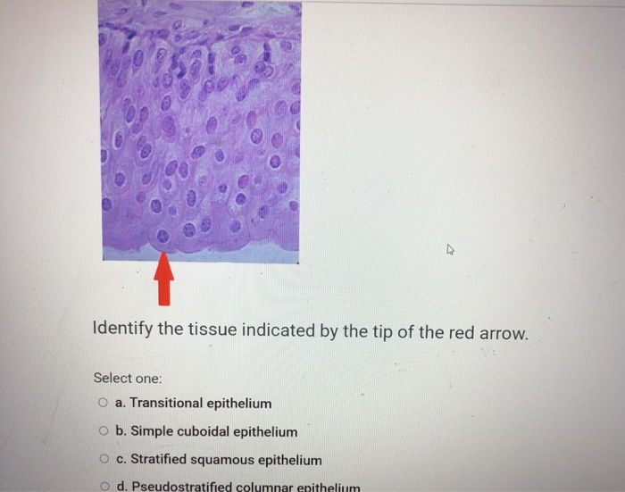 Solved Identify The Tissue Indicated By The Tip Of The Red | Chegg.com