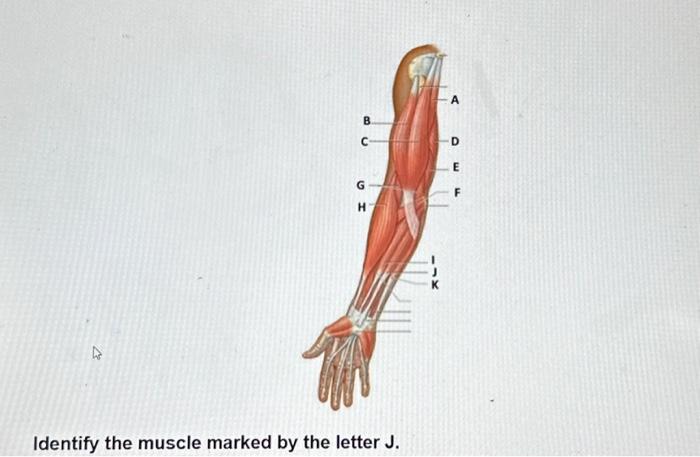 Solved Identify the muscle marked by the letter I.Identify | Chegg.com