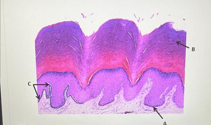 Solved B What tissue is depicted above? What is layer A? | Chegg.com