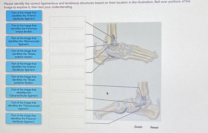 Solved Please Identify The Correct Ligamentous And Tendinous 