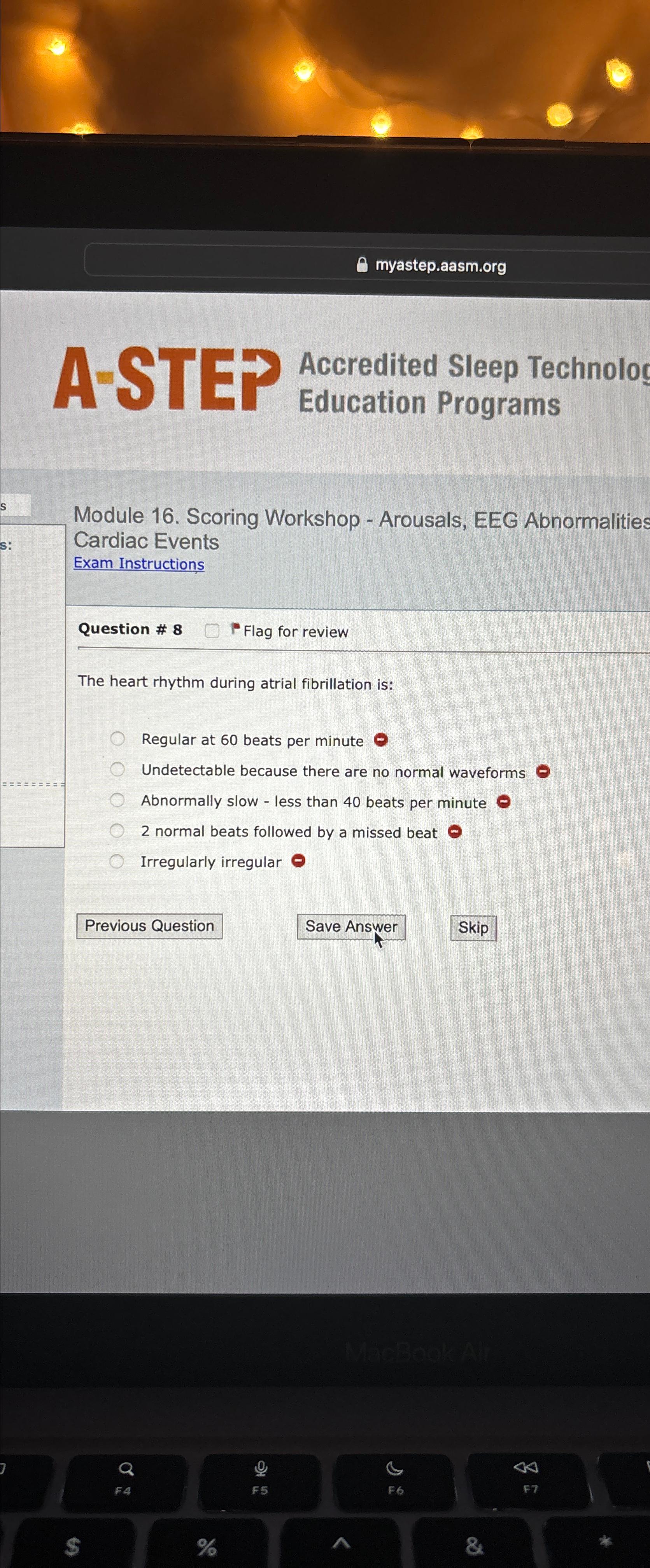 Solved Sleep Technoloc