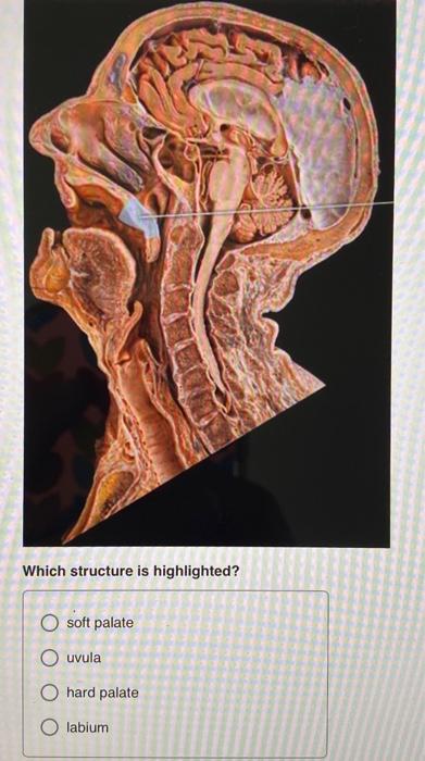 solved-which-structure-is-highlighted-soft-palate-ouvula-o-chegg