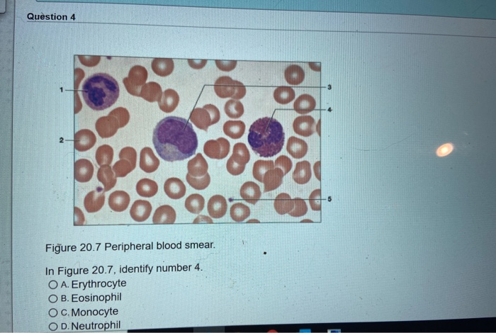 Label The Formed Elements On The Peripheral Blood Smear In Figure 20 7 ...
