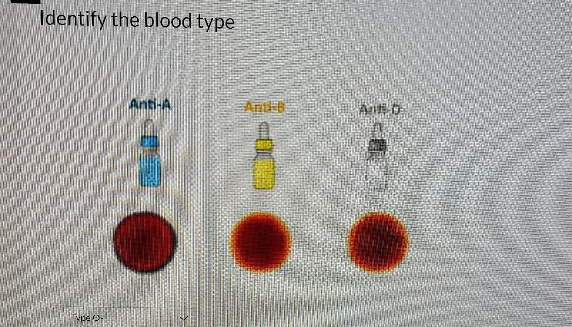 Identify The Blood Type Anti-A Anti-B Anti-D Ce Type | Chegg.com