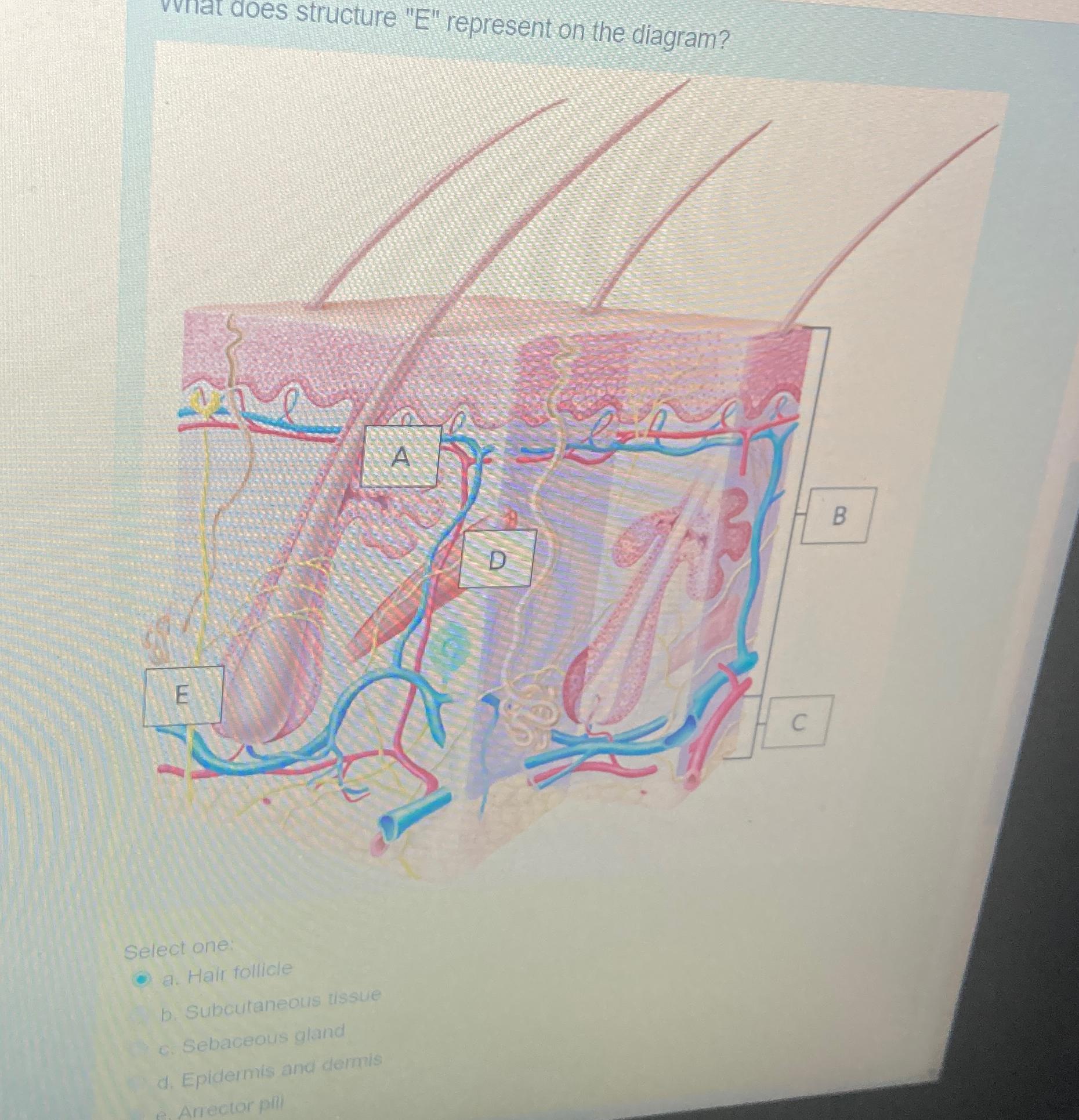 solved-vnat-does-structure-e-represent-on-the-chegg