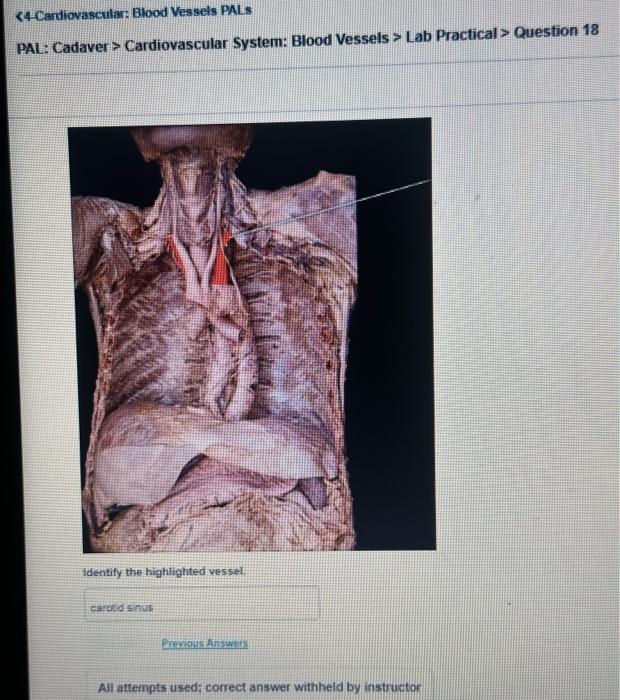 Solved 44Cardiovascular Blood Vessels PALs PAL Cadaver >
