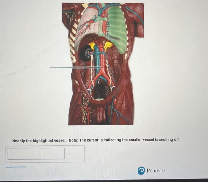 Solved Identify The Highlighted Vessel. Note: The Cursor Is | Chegg.com