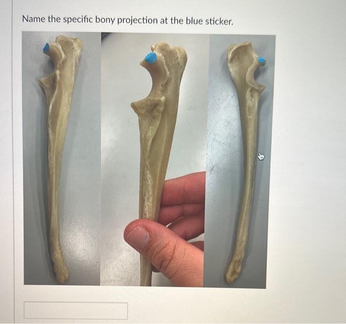 Solved indicated by the green lines. Name the specific bony | Chegg.com