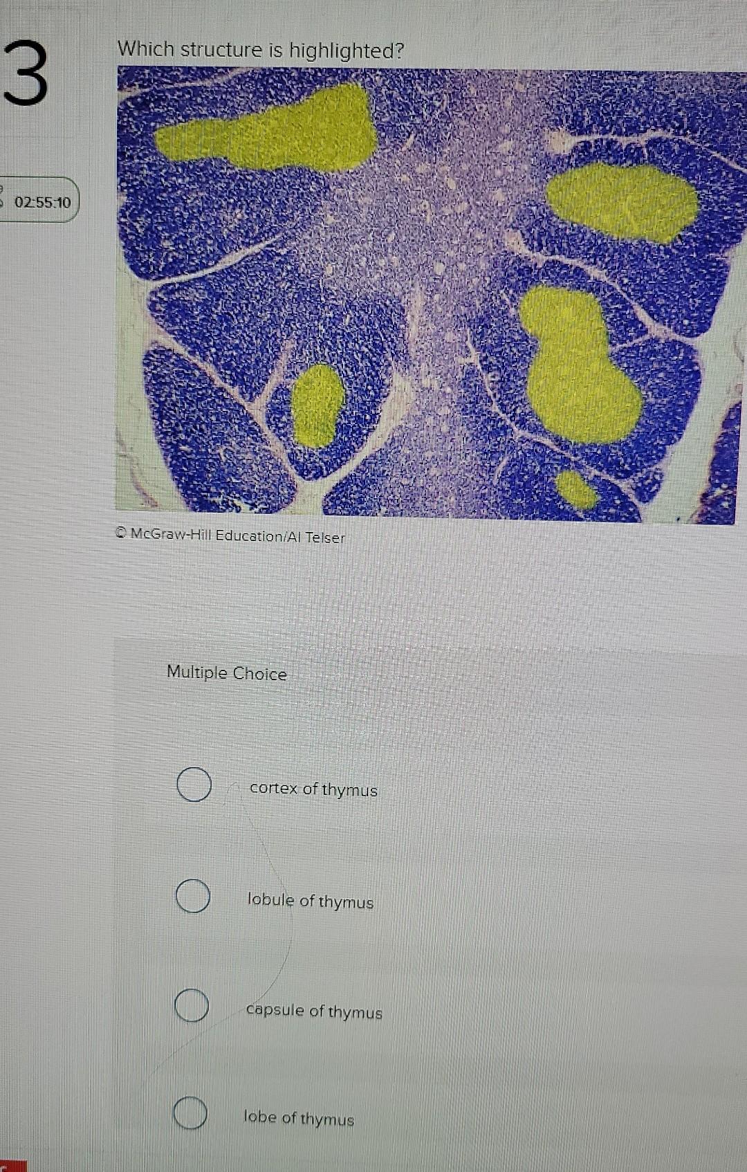 which-structure-is-highlighted-3-02-55-10-chegg