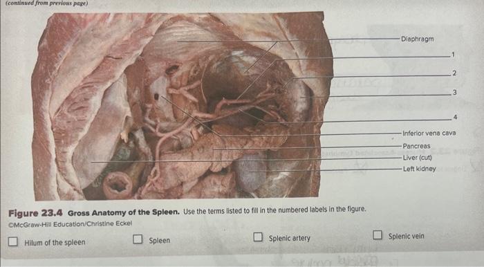 spleen anatomy gross