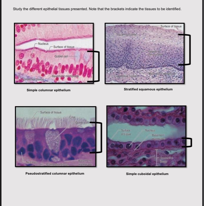 Solved Study The Different Epithelial Tissues Presented. 