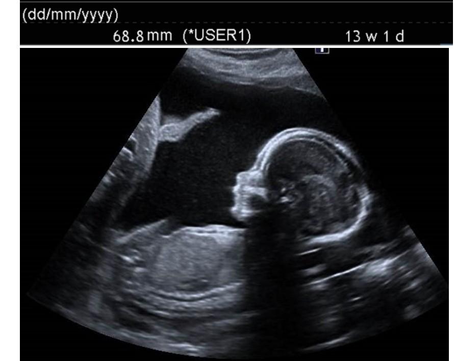 Solved Each ultrasound image has a part of the fetal | Chegg.com