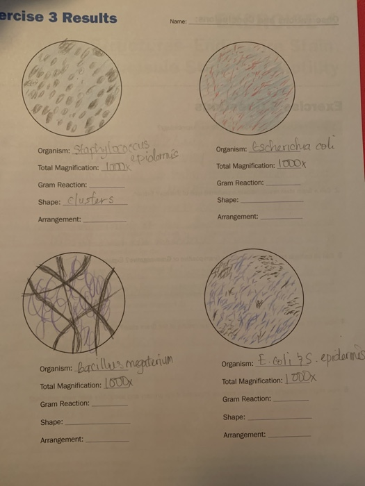Solved Ercise 3 Results Name Organism Sarhylococcus Epi Chegg Com Solved Ercise 3 Results Name Organism Sarhylococcus Epi Chegg Com