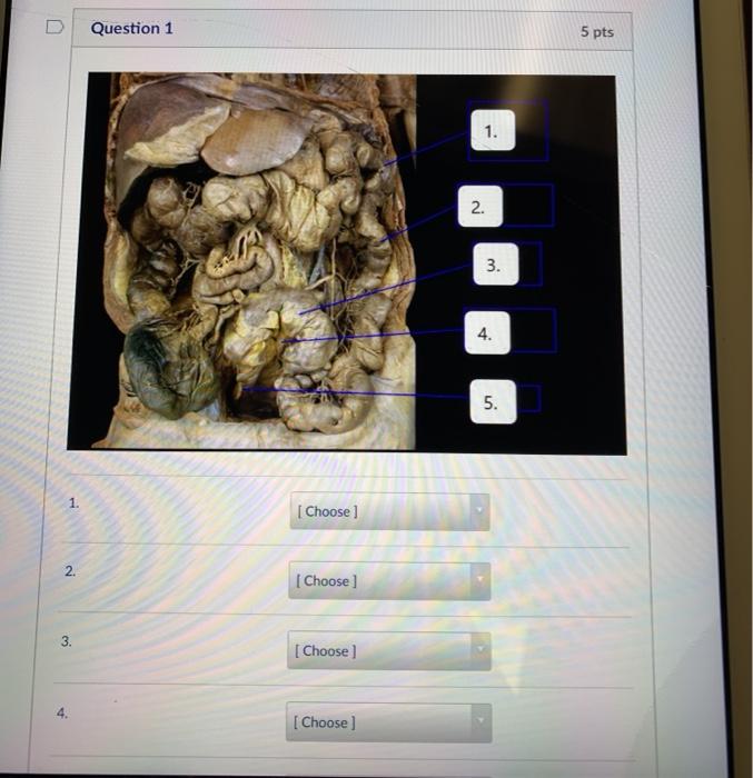 Solved Question 1 5 Pts 1 2 2 3 3 4 1 5 Choose 2 Chegg