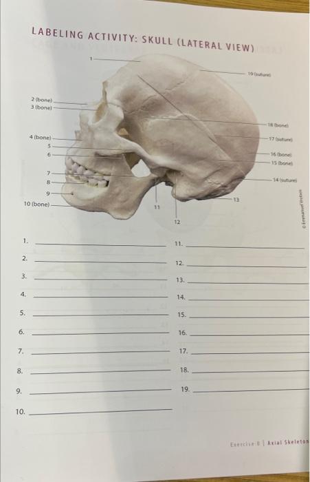 LABELING ACTIVITY: SKULL (LATERAL VIEW) 1 \( 1 . \) 11. \( 2 . \) \( 12 . \) \( 3 . \) 13. 4. \( 14 . \) \( 5 . \) 15 . \( 6