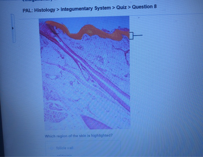 Solved PAL: Histology > Integumentary System > Quiz > | Chegg.com