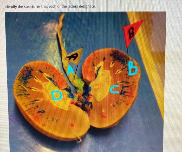 Solved Identify the structures that each of the letters | Chegg.com
