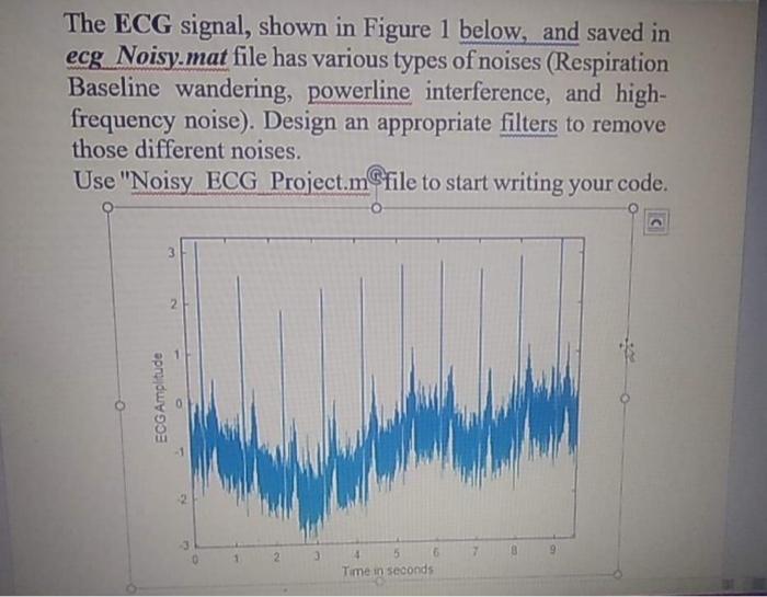 Solved The ECG signal, shown in Figure 1 below, and saved in | Chegg.com