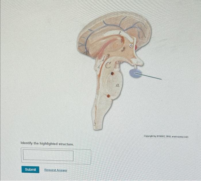 Solved Model courtesy or Ward's Natural Science | Chegg.com