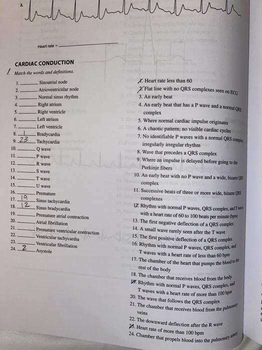 پارلمالح Heart rate CARDIAC CONDUCTION Match the words and definitions, 1. Sinoatrial pode 2. Atrioventricular node 3. Normal