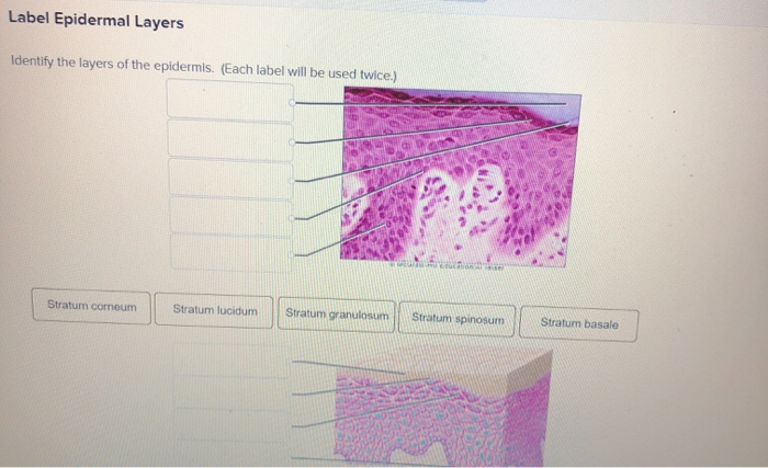 Solved Label Epidermal Layers Identify The Layers Of The