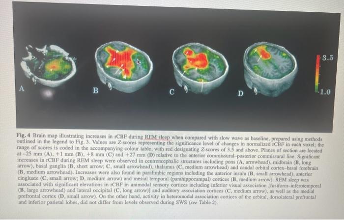 Fig. 5 Brain map illustrating increases in rCBF | Chegg.com