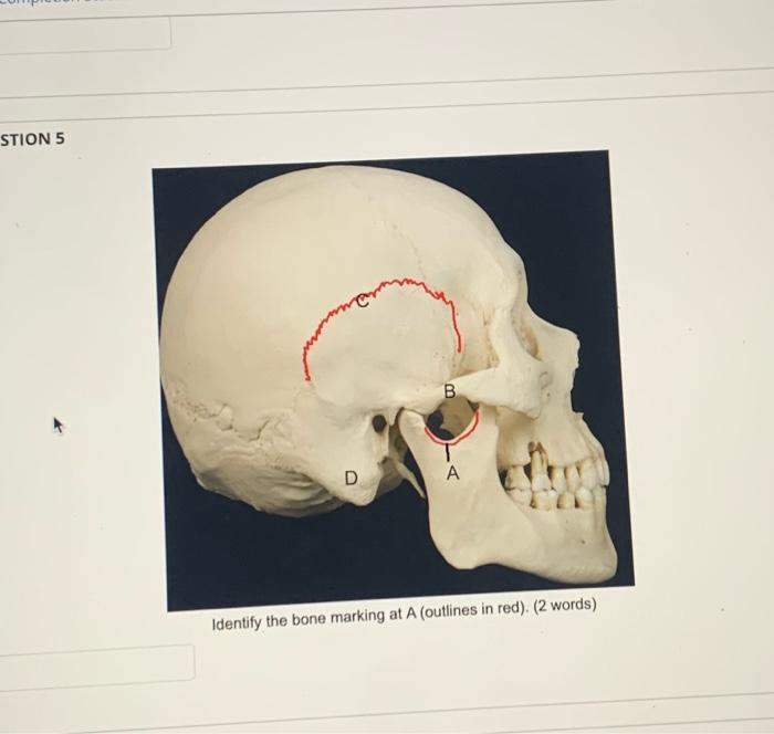 Solved STION 5 Identify the bone marking at A (outlines in | Chegg.com