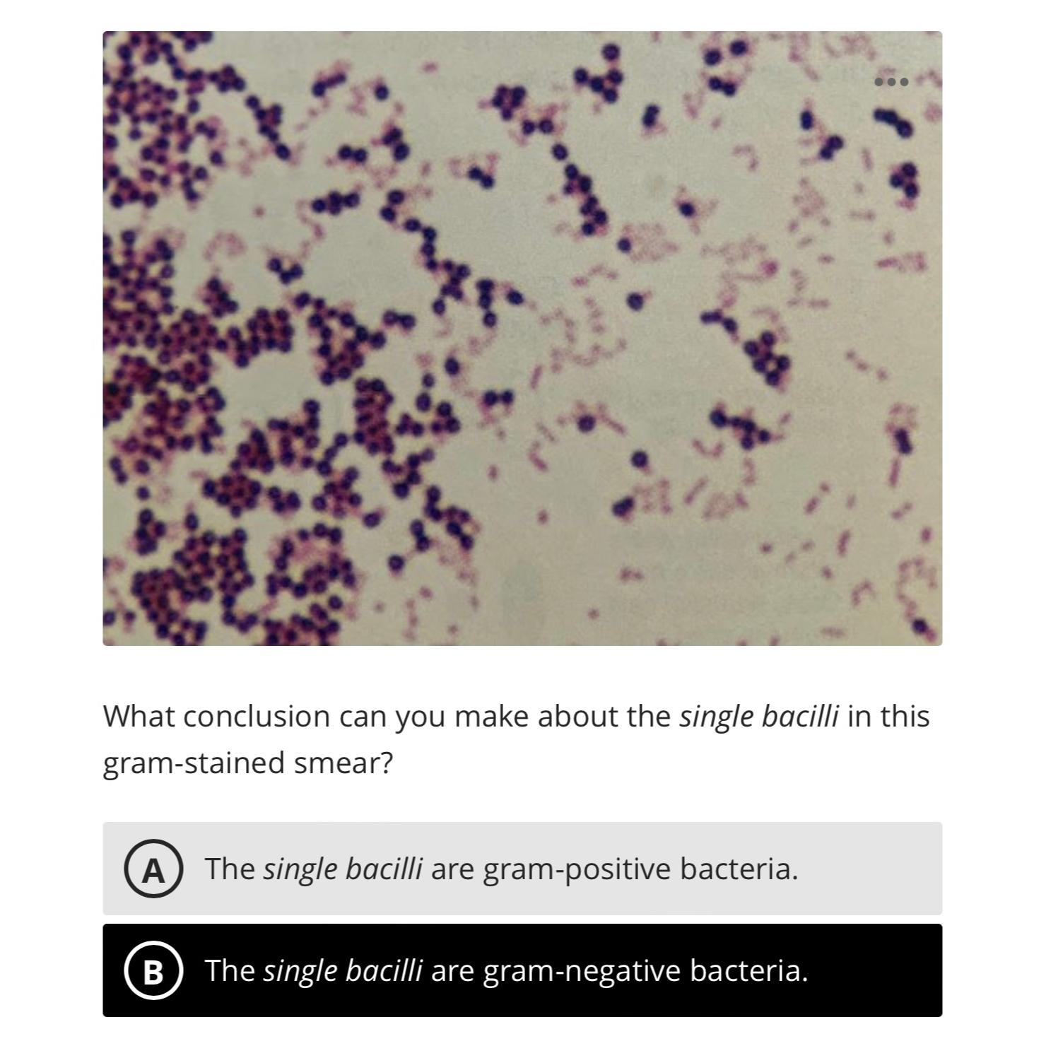 Solved What conclusion can you make about the single bacilli | Chegg.com